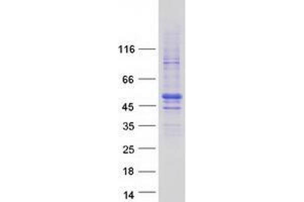 ZNHIT2 Protein (Myc-DYKDDDDK Tag)