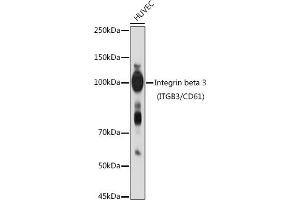 Western blot analysis of extracts of HUVEC cells, using Integrin beta 3 (ITGB3/CD61) antibody (ABIN6127572, ABIN6142584, ABIN6142586 and ABIN6219636) at 1:1000 dilution. (Integrin beta 3 antibody  (AA 610-718))