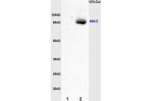 L1 rat kidney lysates L2 rat brain lysates probed with Anti Smoothened/SMO Polyclonal Antibody, Unconjugated (ABIN680908) at 1:200 overnight at 4 °C. (SMO antibody  (AA 551-650))