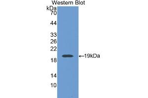 Detection of Recombinant Thrombomodulin, Rat using Polyclonal Antibody to Thrombomodulin (TM) (Thrombomodulin antibody  (AA 324-480))