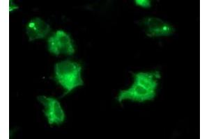 Immunofluorescence (IF) image for anti-Interferon Regulatory Factor 6 (IRF6) antibody (ABIN1498903) (IRF6 antibody)