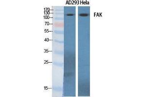 Western Blotting (WB) image for anti-PTK2 Protein tyrosine Kinase 2 (PTK2) (Thr451) antibody (ABIN3184585) (FAK antibody  (Thr451))