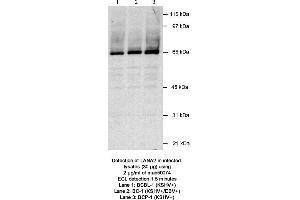 Image no. 1 for anti-Latency-Associated Nuclear Antigen 2 (LANA2) antibody (ABIN363228) (Latency-Associated Nuclear Antigen 2 (LANA2) antibody)