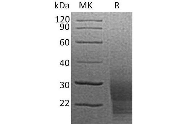 KIT Ligand Protein (KITLG) (His tag)