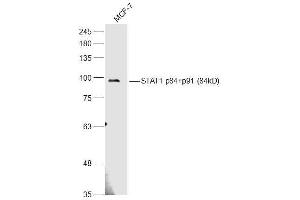 MCF-7 lysates probed with STAT1 p84+p91 Polyclonal Antibody, Unconjugated  at 1:500 dilution and 4˚C overnight incubation. (STAT1 antibody)