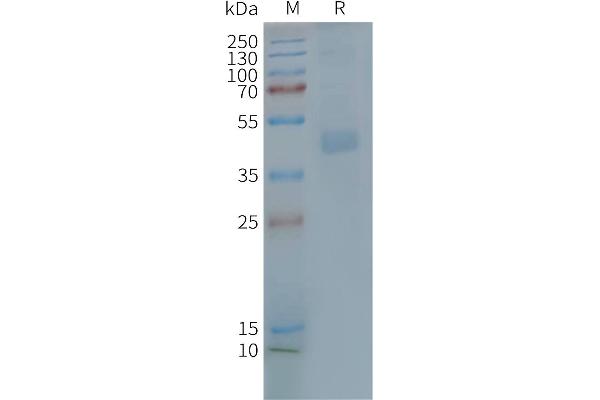 CX3CR1 Protein