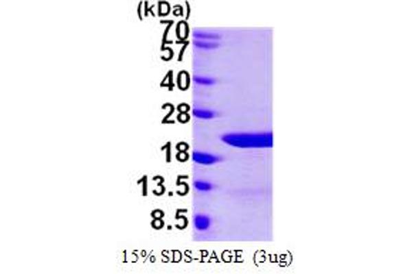 EIF1AY Protein (AA 1-144) (His tag)