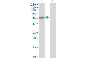 Western Blot analysis of RANBP3 expression in transfected 293T cell line by RANBP3 monoclonal antibody (M01), clone 2E10. (RanBP3 antibody  (AA 298-397))