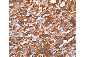 Immunohistochemistry of Human brain  using GAS8 Polyclonal Antibody at dilution of 1:40 (GAS8 antibody)