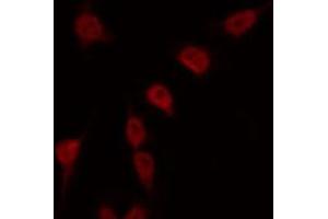 ABIN6269401 staining Hela by IF/ICC. (RPS6KB2 antibody  (C-Term))