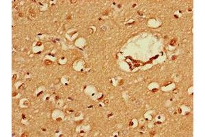 Immunohistochemistry of paraffin-embedded human brain tissue using ABIN7152586 at dilution of 1:100 (FEZ1 antibody  (AA 12-200))