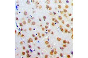 Immunohistochemical analysis of SNAP25 staining in human brain formalin fixed paraffin embedded tissue section. (SNAP25 antibody  (C-Term))