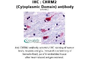 Image no. 1 for anti-Cholinergic Receptor, Muscarinic 2 (CHRM2) antibody (ABIN1733057) (Muscarinic Acetylcholine Receptor M2 antibody)