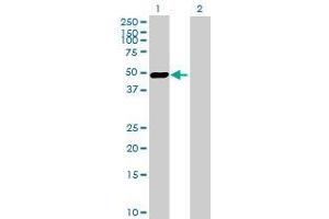 Lane 1: PLEK transfected lysate ( 40. (PLEK 293T Cell Transient Overexpression Lysate(Denatured))