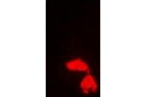 Immunofluorescent analysis of PA28 gamma staining in Hela cells. (PSME3 antibody)
