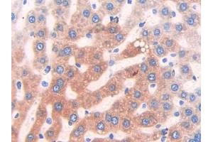 IHC-P analysis of Rat Liver Tissue, with DAB staining. (CYP2E1 antibody  (AA 126-309))