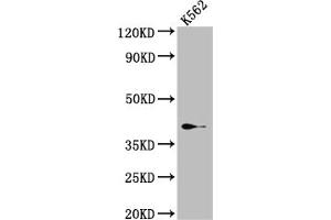 Western Blot Positive WB detected in: K562 whole cell lysate All lanes: SAE1 Antibody at 1:1000 Secondary Goat polyclonal to rabbit IgG at 1/50000 dilution Predicted band size: 39, 30, 34 kDa Observed band size: 39 kDa (Recombinant SAE1 antibody)