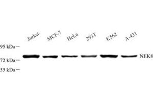 Western blot analysis of Nek8 (ABIN7074843) at dilution of 1: 1000 (NEK8 antibody)