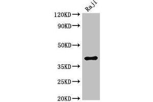 Western Blot Positive WB detected in: Raji whole cell lysate All lanes: HMBS antibody at 3 μg/mL Secondary Goat polyclonal to rabbit IgG at 1/50000 dilution Predicted band size: 40, 38, 35, 34 kDa Observed band size: 40 kDa (HMBS antibody  (AA 283-330))