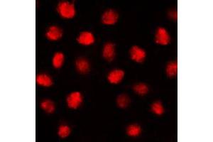 Immunofluorescent analysis of EGR1 staining in MCF7 cells. (EGR1 + EGR2 (C-Term) antibody)