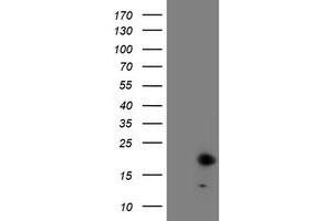 HEK293T cells were transfected with the pCMV6-ENTRY control (Left lane) or pCMV6-ENTRY FXN (Right lane) cDNA for 48 hrs and lysed. (Frataxin antibody)