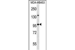 Western blot analysis in MDA-MB453 cell line lysates (35ug/lane). (NUP88 antibody  (C-Term))