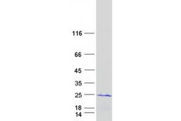 CIRBP Protein (Transcript Variant 1) (Myc-DYKDDDDK Tag)