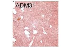 Antibody- or peptide-mediated disruption of the human FcRn–albumin interactions decreases chemical hepatotoxicity. (FcRn antibody)