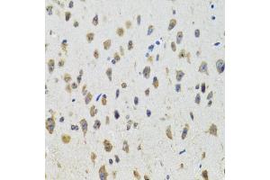 Immunohistochemistry of paraffin-embedded mouse brain using CYP19A1 antibody (ABIN5971188) at dilution of 1/100 (40x lens). (Aromatase antibody)