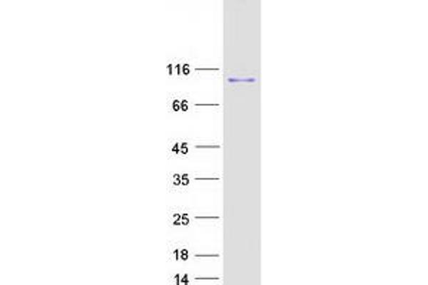 SSRP1 Protein (Myc-DYKDDDDK Tag)