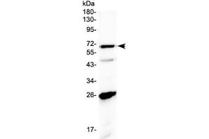 Western blot testing of human A431 cell lysate with SLC7A3 antibody at 0. (SLC7A3 antibody  (AA 1-30))