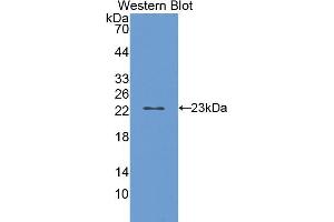 Western blot analysis of the recombinant protein. (CYP2E1 antibody  (AA 126-309))