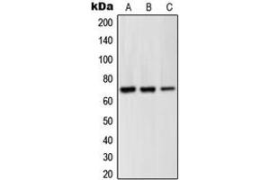 Western blot analysis of GRK6 expression in Jurkat (A), BJAB (B), Ramos (C) whole cell lysates. (GRK6 antibody  (N-Term))