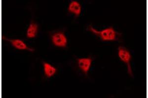 ABIN6274676 staining HeLa by IF/ICC. (BARD1 antibody  (Internal Region))