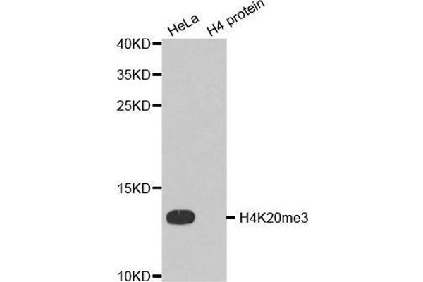 Histone H4 antibody  (3meLys20)