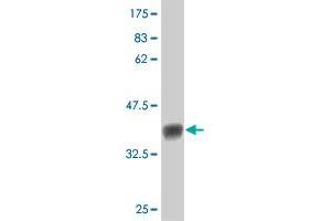 Western Blot detection against Immunogen (36. (FLT4 antibody  (AA 34-133))