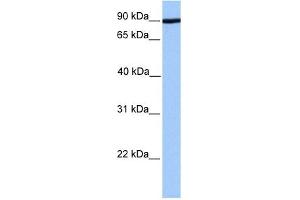 ADAM2 antibody used at 1 ug/ml to detect target protein. (ADAM2 antibody)