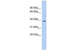 APOL6 antibody used at 0. (APOL6 antibody  (Middle Region))