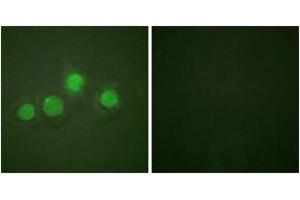 Immunofluorescence analysis of HuvEc cells, using GATA4 (Phospho-Ser262) Antibody. (GATA4 antibody  (pSer262))