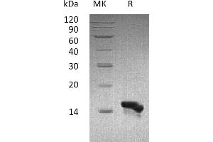 Greater than 95 % as determined by reducing SDS-PAGE. (CCL28 Protein)