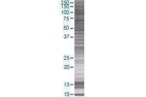 LRRC61 transfected lysate. (LRRC61 293T Cell Transient Overexpression Lysate(Denatured))