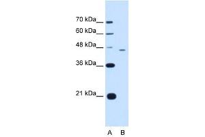 FEN1 antibody used at 1. (FEN1 antibody  (C-Term))