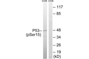 Western blot analysis of extracts from COS7 cells, using p53 (Phospho-Ser15) antibody. (p53 antibody  (pSer15))