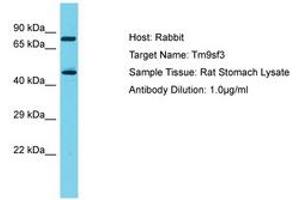 Image no. 1 for anti-Transmembrane 9 Superfamily Member 3 (TM9SF3) (AA 187-236) antibody (ABIN6750318) (TM9SF3 antibody  (AA 187-236))