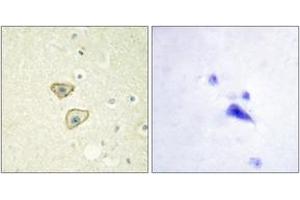Immunohistochemistry (IHC) image for anti-Epidermal Growth Factor Receptor (EGFR) (AA 986-1035) antibody (ABIN2888655) (EGFR antibody  (AA 986-1035))