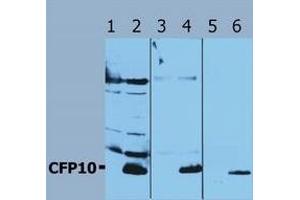 Image no. 1 for anti-Mycobacterium Tuberculosis Antigen CFP10 (Rv3874) antibody (ABIN238347) (Mycobacterium Tuberculosis Antigen CFP10 (Rv3874) antibody)