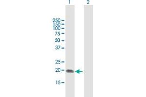 Western Blot analysis of ST6GAL1 expression in transfected 293T cell line by ST6GAL1 MaxPab polyclonal antibody. (ST6GAL1 antibody  (AA 1-175))