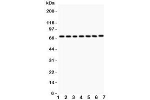 Western blot testing of FOXO3A antibody and Lane 1:  rat thymus;  2: (r) NRK;  3: (r) PC12;  4: human HEPG2;  5: (h) HeLa;  6: (h) K562;  7: (h) Jurkat. (FOXO3 antibody  (AA 471-673))