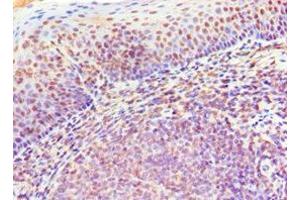 Immunohistochemistry of paraffin-embedded human tonsil tissue using ABIN7145182 at dilution of 1:100 (CD20 antibody  (AA 209-297))