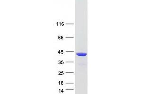 RAD51 Protein (Transcript Variant 1) (Myc-DYKDDDDK Tag)